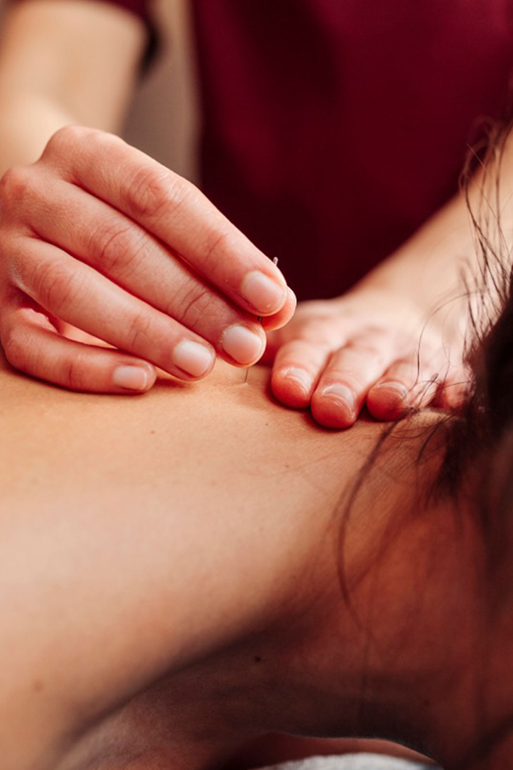 body temple acupuncture treatment